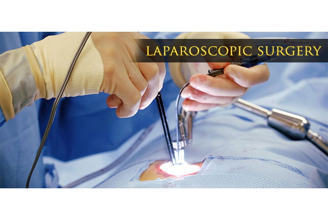 Laparoscopic Surgery Punjab